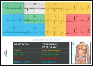 Las Derivaciones En El Electrocardiograma CampusCardio