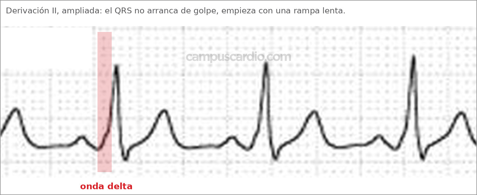 Caso 115, imagen 5